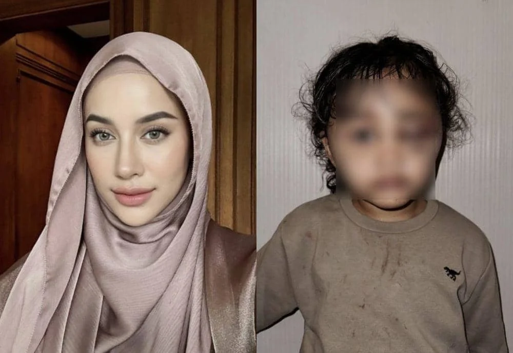 Kontroversi Emy Aghnia Pakai Video Vidi Aldiano untuk Promosi Obat Herbal: Dari Laporan Suster hingga Tanggapan Deddy Corbuzier