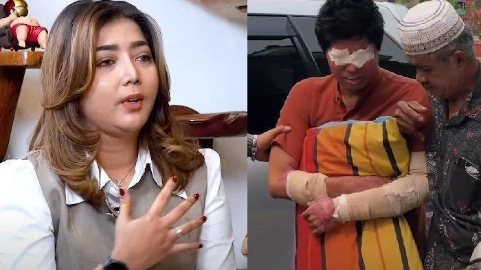 Mata Andrie Yunus Rusak Parah Usai Disiram Air Keras, Kini Dapat Perlindungan LPSK
