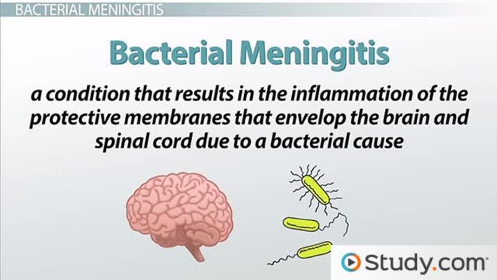 Mengapa Wabah Meningitis Ini Begitu Menggemparkan?